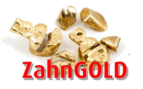 Zahngold gelb/sauber/750 Gold